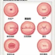 孕期宫颈肥大（孕期宫颈肥大对胎儿有影响吗）
