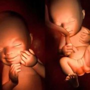 孕13周的胎儿和图片（13周孕妇标准的肚子图）
