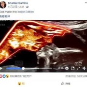 胎儿的父亲（胎儿的父亲死亡）
