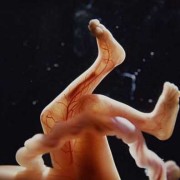 怀孕6个月会出现胎儿缺氧的情况吗,孕六个半月胎儿图片