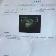 孕期孕酮降低（怀孕44天胎心胎芽都正常但是孕酮降低了怎么回事）