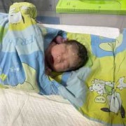 孕34周胎儿偏小（孕34周胎儿有点小打氨基酸有用吗）