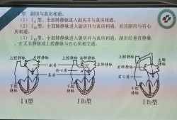 胎儿三房心（胎儿三房心需要引产吗）