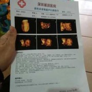 孕期四维彩超做几次（孕期四维彩超做几次合适）