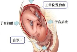 着床于前壁及后壁啥意思,前壁和后壁哪个顺产快