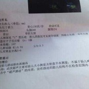27周胎儿头围标准（2021年11月27号对应的新历是）