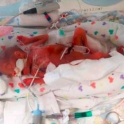 怀孕23周胎儿图片欣赏（怀孕23周胎儿图片大全）
