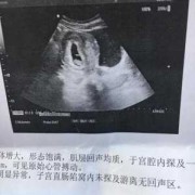 胎儿健康（胎儿健康不健康几个月能查出来呀）