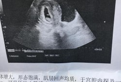 胎儿健康（胎儿健康不健康几个月能查出来呀）