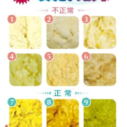 孕妇13周拉了好多屎,孕期拉的多正常么