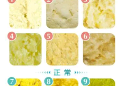 孕妇13周拉了好多屎,孕期拉的多正常么