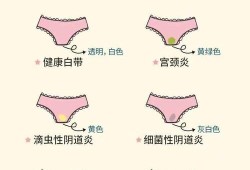 孕期白带多怎么办（孕妇白带多正常吗）