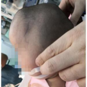 胎儿头圆（一岁宝宝的头型正常是什么样的）
