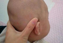 孕期孩子头大是什么原因,胎儿头高能顺产吗