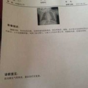 胎儿肺炎（胎儿肺炎产检可以查出来吗）