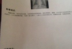 胎儿肺炎（胎儿肺炎产检可以查出来吗）