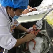 26周早产儿建议抢救吗？要花多少钱的,怀孕26周胎儿多重