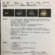 少一个肾算几级残疾,胎儿肾缺失的原因分析