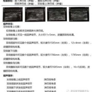 安全b证一年考几次,孕期b超做几次最好