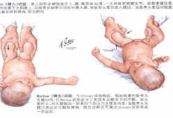 孕期阴阳腿是男宝吗（孕期阴阳腿孩子会有影响吗）