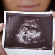 胎儿健康能检查出来吗（胎儿健康能检查出来吗视频）