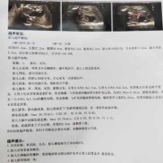 胎儿肾有泡（胎儿肾有泡泡怎么办）