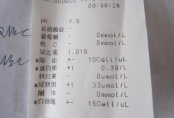 孕期尿蛋白3（尿蛋白3个加号怎么治）