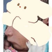 胎儿小下颚（宝宝平躺收下巴正确姿势）