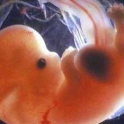胚胎染色体异常再怀孕还会出现吗,胎儿染色体异常有什么后果呢