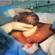 胎儿吸取营养（孕妇可以闻精油吗？对胎儿有什么影响）