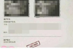 孕周是按实际算还是按b超显示算,怀孕期间怎么算多少周