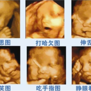 孕期做几次四维（孕期做几次四维彩超检查）