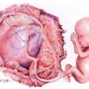 孕妇羊水脏影响胎儿是什么,胎儿吸入胎粪会怎么样有后遗症吗?