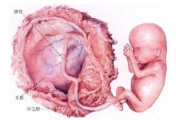 孕妇羊水脏影响胎儿是什么,胎儿吸入胎粪会怎么样有后遗症吗?