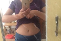 孕期上身变胖（上身胖、腿特别细，这样的体型正常吗）