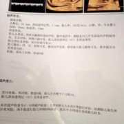 胎儿心率高是女孩吗（胎儿心率高是女孩吗?）