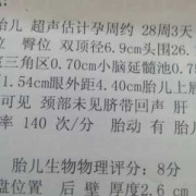 一般胎儿生物物理评分是多少分才好,胎儿物理评分8分正常吗
