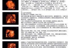 三维彩超结果怎么看,胎儿三维和四维有什么区别