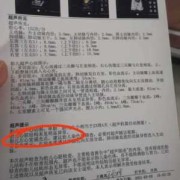 胎儿左心室有强光点复查变大了，不知怎么办好,胎儿右心增大的原因以及如何治疗