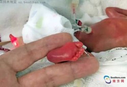 胎儿一个月能长多少斤（宝宝出生半个月就已经长了1斤了，这正常吗）