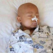 胎儿白血病（小孩白血病是由什么引起的）