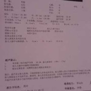 胎儿脑动脉正常值（胎儿脑动脉正常值是多少）