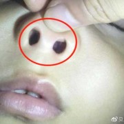 宝宝鼻子里呼哧呼哧但又不见鼻涕流出来，怎么回事,胎儿没鼻子是什么原因