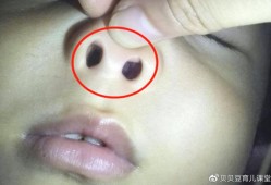 宝宝鼻子里呼哧呼哧但又不见鼻涕流出来，怎么回事,胎儿没鼻子是什么原因
