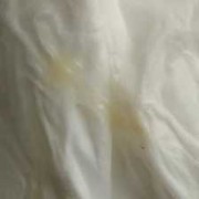 怀孕期间白带发黄对宝宝有影响吗,