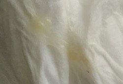怀孕期间白带发黄对宝宝有影响吗,