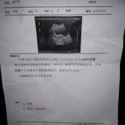 保胎针对胎儿有影响吗（孕晚期打保胎针对胎儿有影响吗）