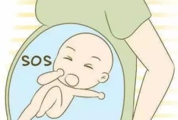 胎儿的顶臂长指的是哪里的长度,胎儿肢体屈曲症能治吗