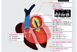 胎儿二尖瓣反流（胎儿二尖瓣反流是什么意思）