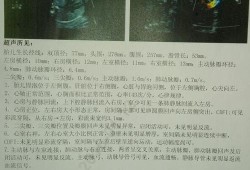 怀孕28周四维左心室强光斑胎儿肠管稍增强严重吗,胎儿左心室两个强光斑是什么意思